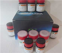 SBJ-0550乙型肝炎病毒染色试剂盒(Shikata地衣红法)